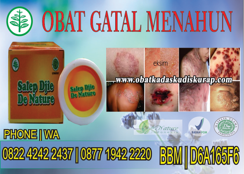 Illustration for article titled obat kurap manjur